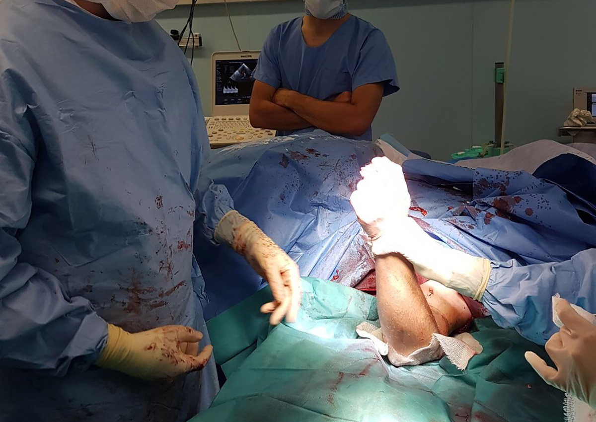 Surgeons in France reattach woman's arms after train accident