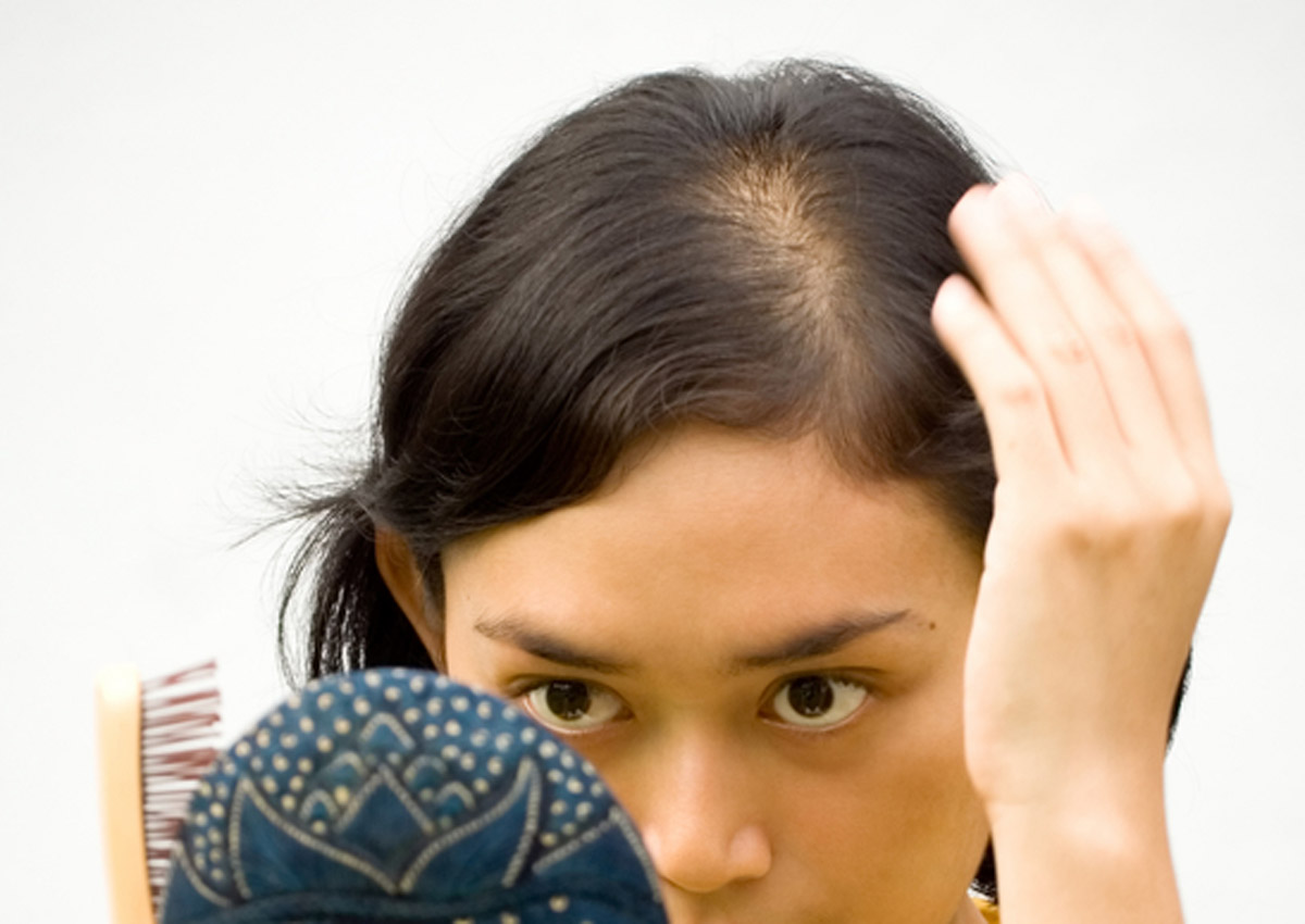 It's time to talk about women and hair loss