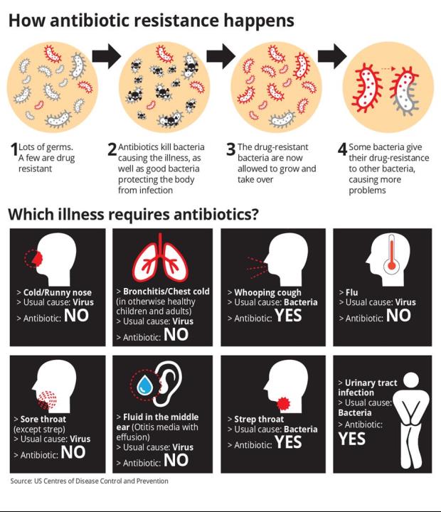 Check if you really need antibiotics