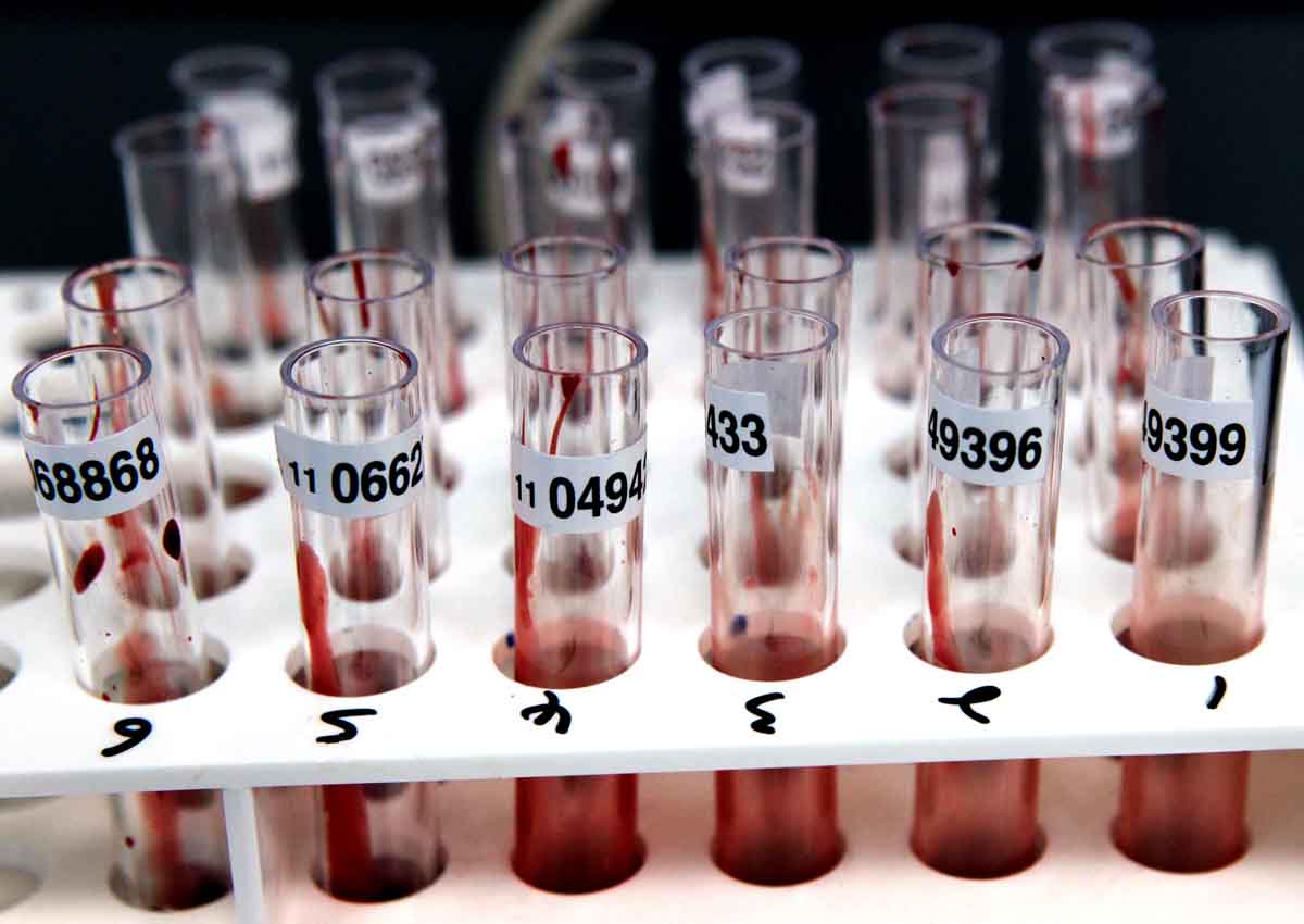Cancer blood test finds eight kinds of tumours: Study