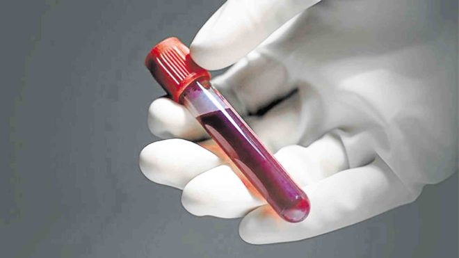 Finally, there's a blood test to screen for early-stage cancer